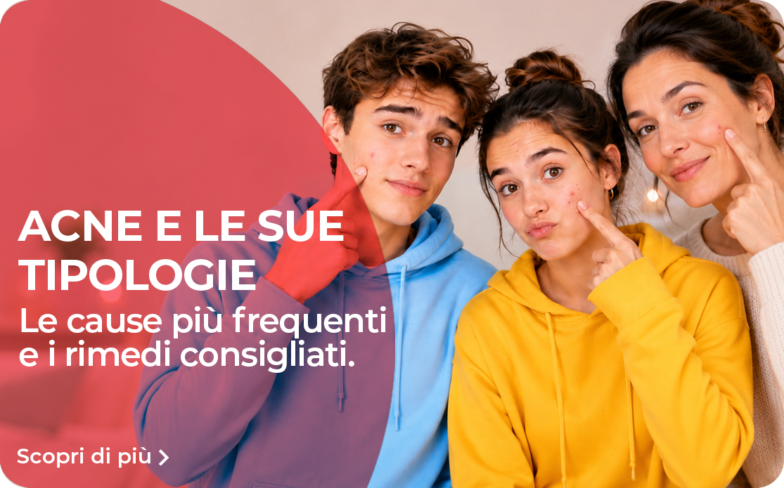 acne patologie e rimedi